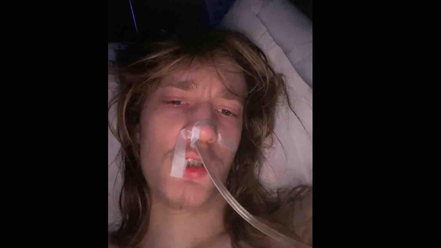 Malkolm in the hospital post-surgery with a nasal tube